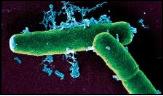Bacteria Anthrax