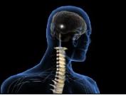Cerebro