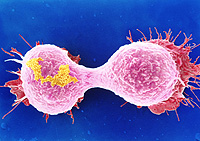 Célula cancerosa 2