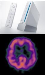 Parkinson_wii